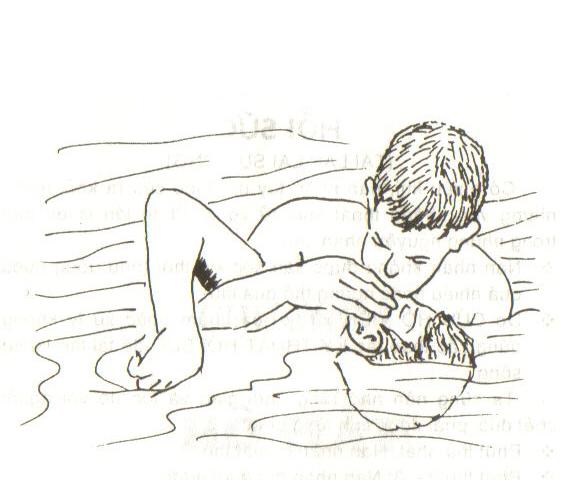 phương pháp hô hấp nhân tạo