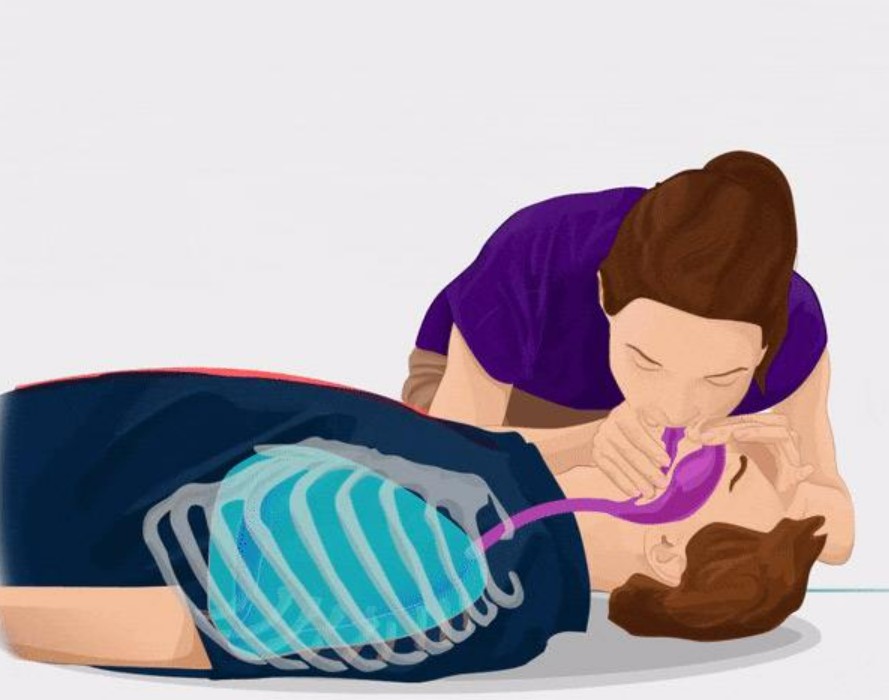 Cách xử lý ngạt khói