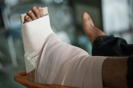 các bước sơ cứu người bị gãy xương